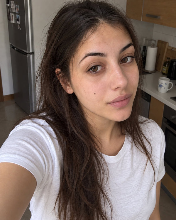 Dopo